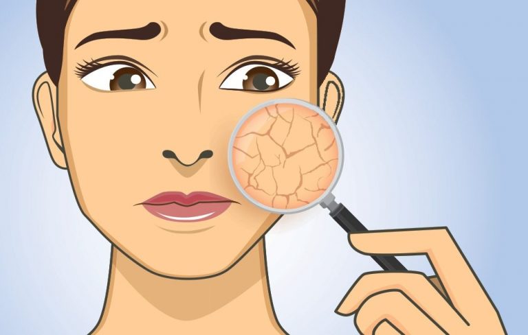 Dry Skin: These 5 Home Remedies Will Help