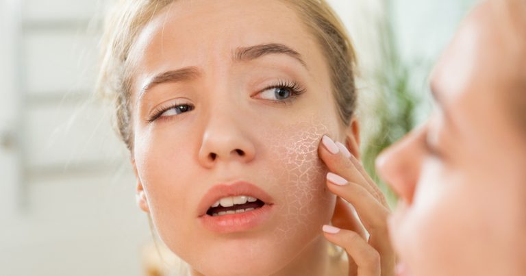Food for Dry Skin